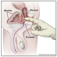 prostatitis treatment acupuncture