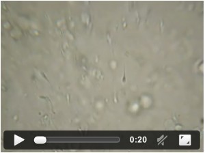 video of semen analysis